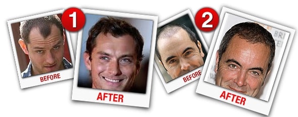 hair revital x before and after